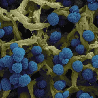 The Scavenger Inside Your Nose
