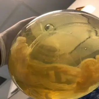 Deciphering the Biofilm matrix