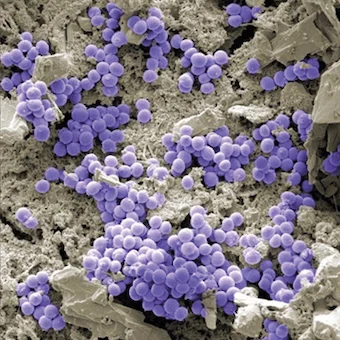 International biofilm centers launch Priority Questions Exercise