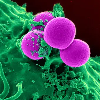 Protozoans and pathogens make for an infectious mix
